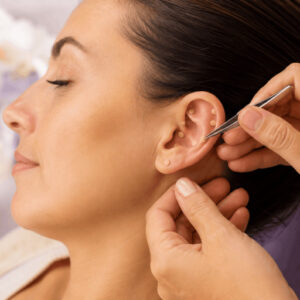 Auriculoterapia